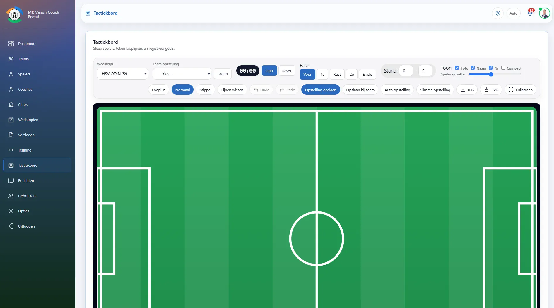 MK Vision Coach Portal projectbeeld 2